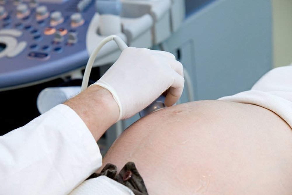 Как проводится УЗИ почек при беременности? - Твои Почки